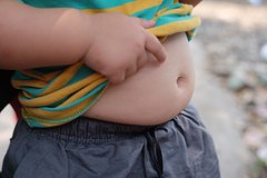 Подробнее о статье Хирург рассказал о влиянии детского ожирения на взрослую жизнь человека